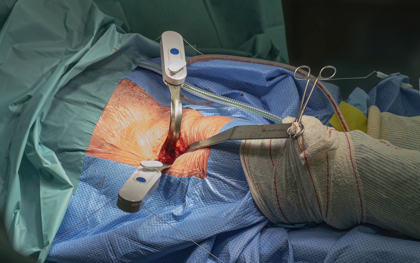 Gripper™ systemet – Kirurgens assistent