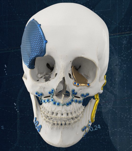Materialise